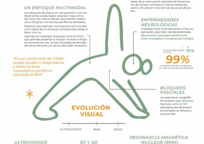 3 avances en el bloqueo de plexos