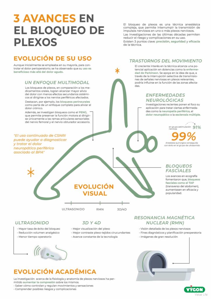 3 avances en el bloqueo de plexos