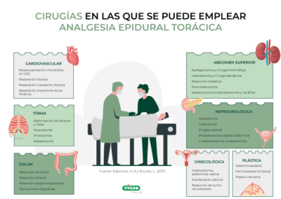 Cirugías en las que emplear analgesia epidural torácica
