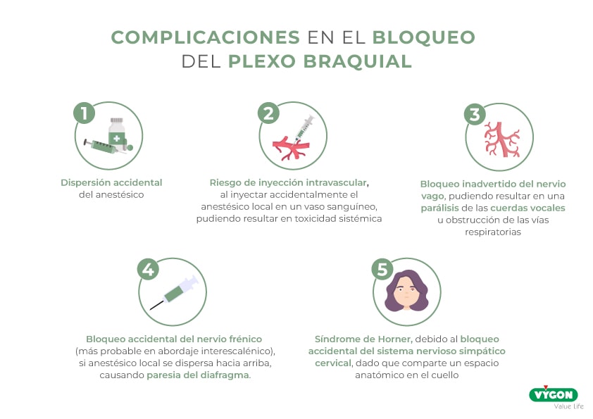 Complicaciones bloqueo plexo braquial