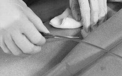 ¿Qué hacer cuando no se puede colocar un picc? Uso del FICC con método RaFeVa