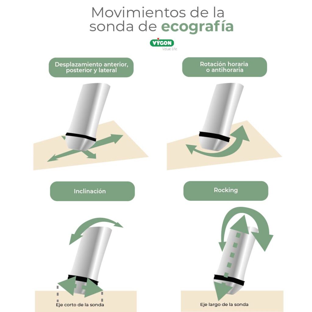Movimientos de la sonda de ecografía