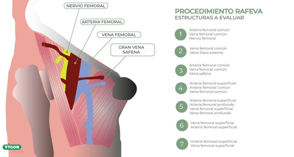 Protocolo RaFeVa. Estructuras a evaluar según el orden de la infografía del 1 al 7.