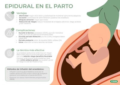 Anestesia epidural en el parto