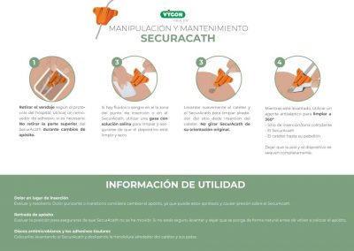 Manipulación y mantenimiento de SecurAcath