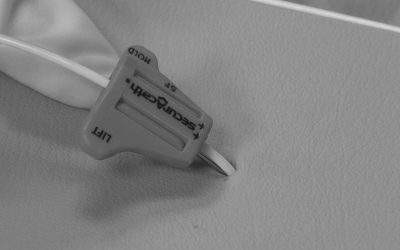 Complicaciones y elección de sistemas de fijación en pacientes pediátricos y neonatales