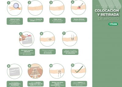 Técnicas de colocación y retirada de apósito