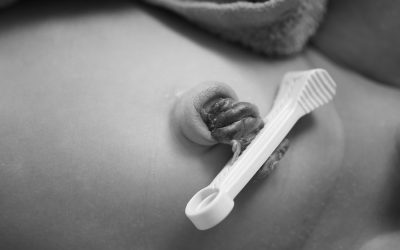 Inserción segura de catéteres umbilicales ¿Cuáles son las ultimas recomendaciones para una mejor atención neonatal?