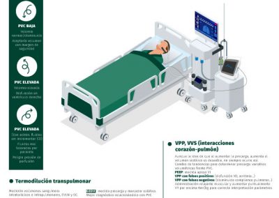 4 técnicas de monitorización en sobrecarga de volumen y/o pacientes en situación de shock séptico o alto riesgo quirúrgico