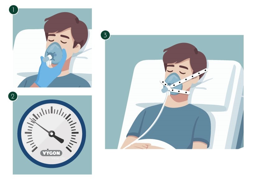 CPAP con manómetro para monitorizar SWING