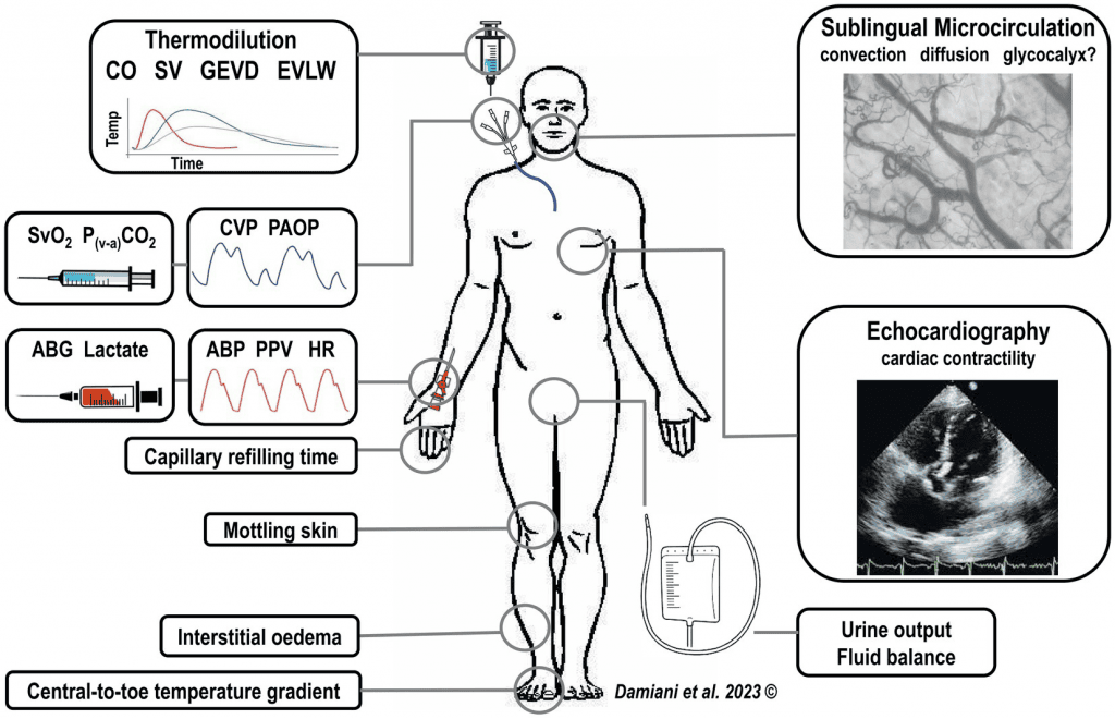 Microcirculación